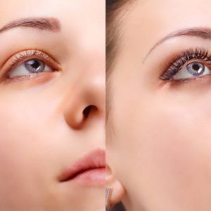 Comparison of female eyes before and after eyelash extension